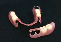 ノンクラスプ義歯